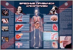 Электрифицированный стенд "Вредные привычки: алкоголизм" - fgospostavki.ru - Лобня