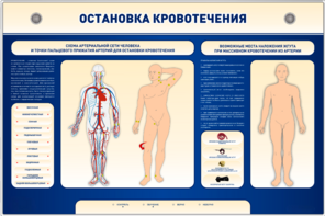 Электрифицированный стенд-тренажер "Остановка кровотечения" - fgospostavki.ru - Лобня
